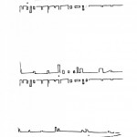 Calvino – dos rectas paralelas y el en medio