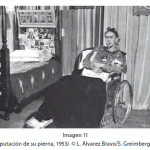 frida despues de la amputacion de su pierna