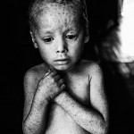 the-human-cost-of-agrotoxin