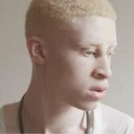 Un negro albino es más blanco que un blanco y difiera en sólo uno de sus 23.000 genes respecto de un negro no albino, imágen para libro, Alberto Kornblihtt